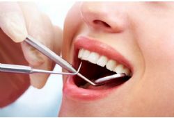 How to Rate Your Dental Examination